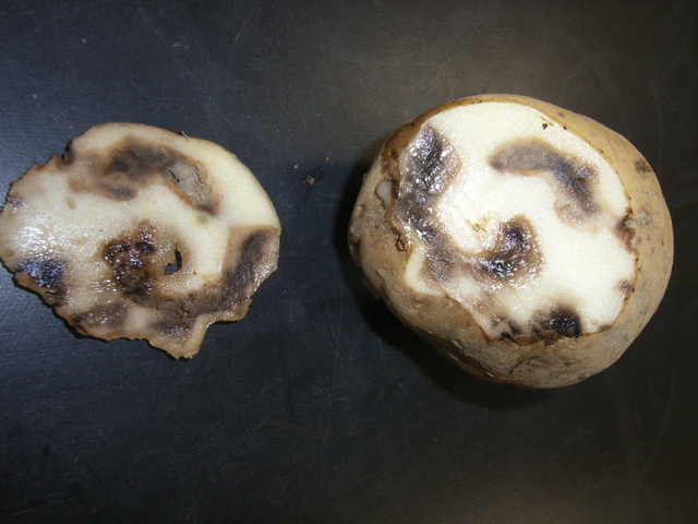 日焼け症状